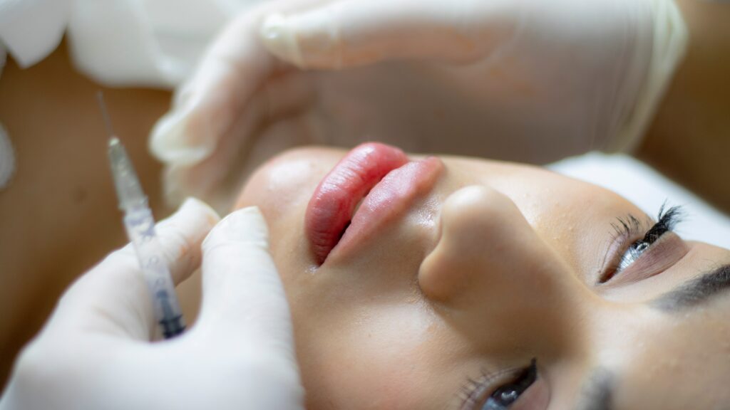 Filler ร่องแก้มต้องที่ KeTHAT Clinic เสริมความงามครบวงจร
