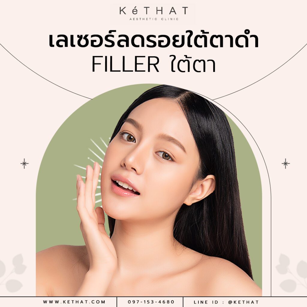 กำจัดรอบดำใต้ตาด้วยการฉีดฟิลเลอร์ใต้ตา
