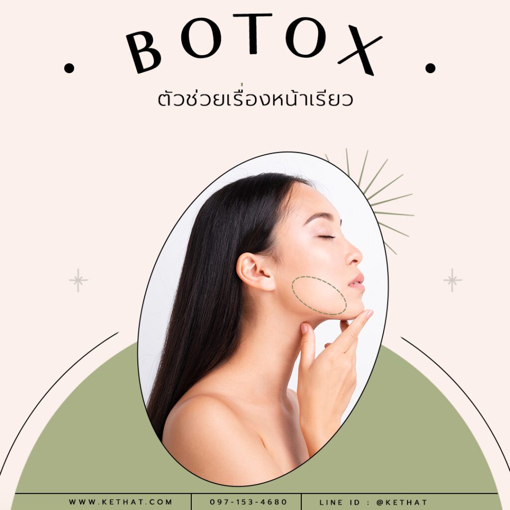 BOTOX ตัวช่วยเรื่องหน้าเรียว