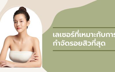 รู้จัก 5 ประเภท “เลเซอร์สิว” ที่เหมาะกับการกำจัดรอยสิวที่ดีที่สุด
