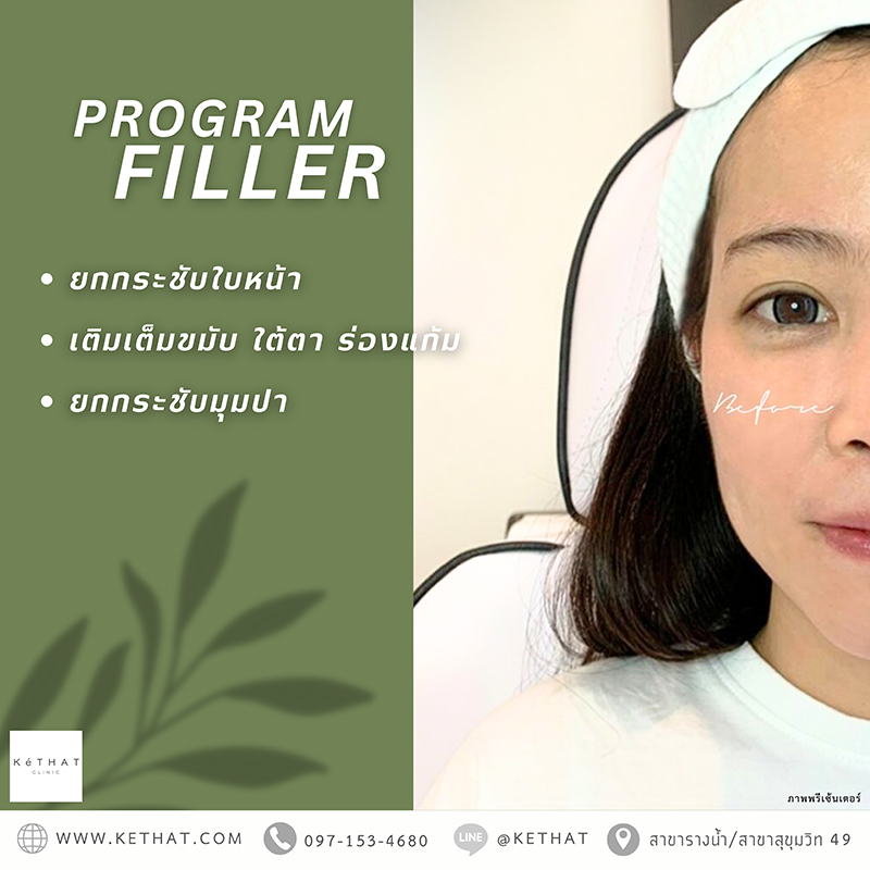filler ยกกระชับ