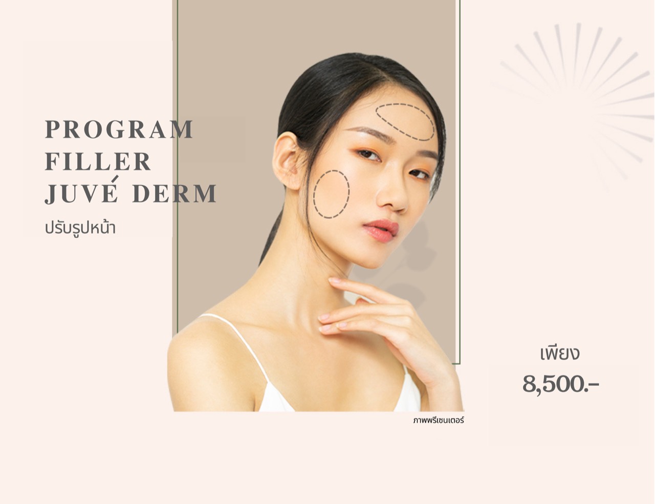 ราคาฉีด filler 