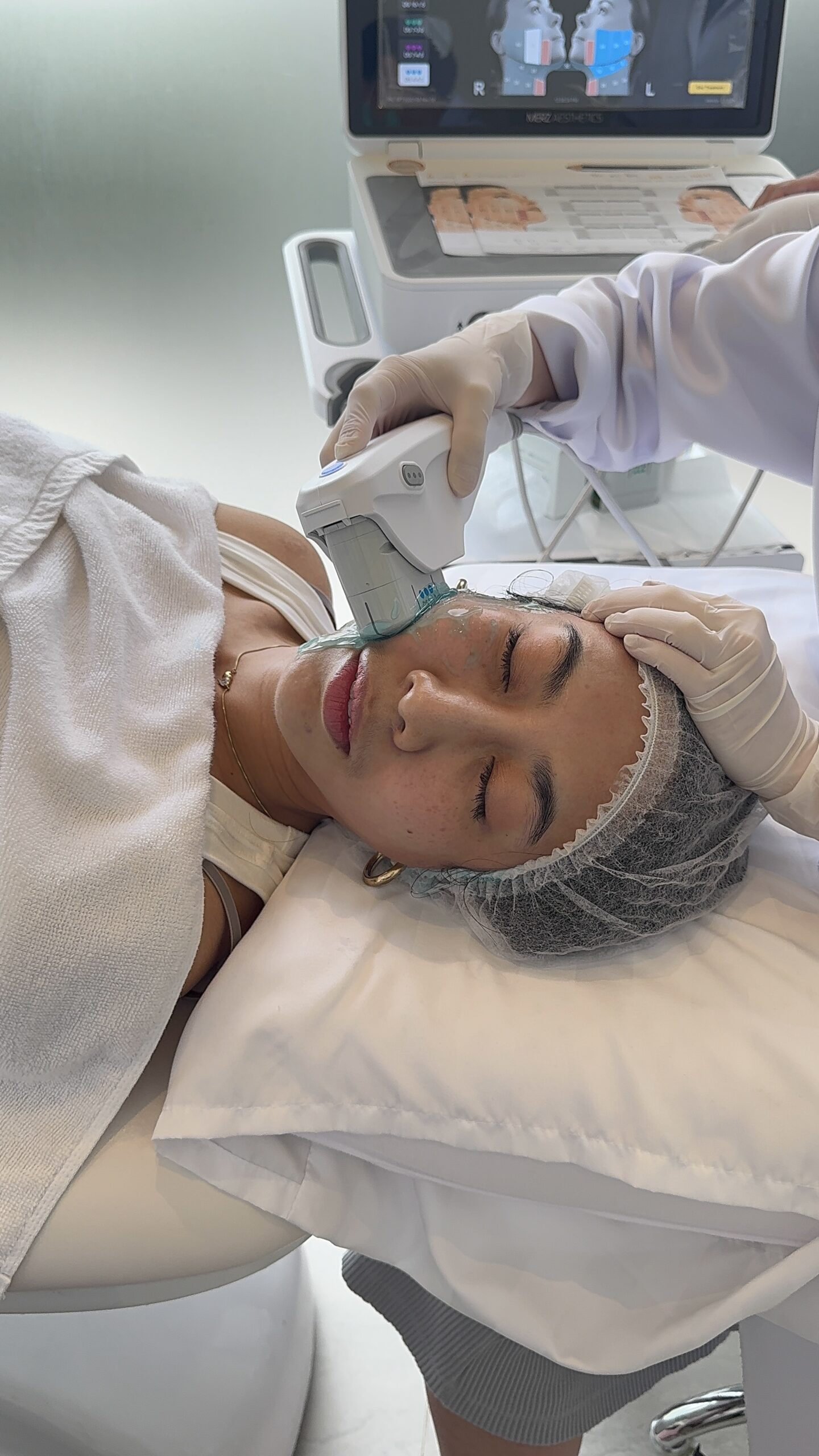 Ulthera Prime คืออะไร เครื่อง ที่ Kéthat Clinic 2026